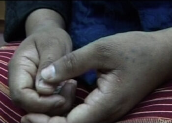 Domestic violence on the rise