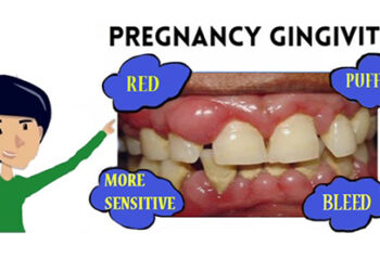 Poor practise of oral hygiene among pregnant mothers, research finds