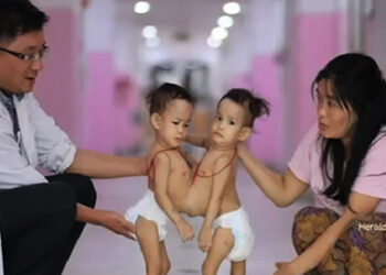 Bhutan’s first conjoined twins in Australia for separation surgery