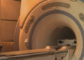 JDWNRH to resume MRI service from next month