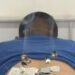 First clinical trial of warm acupuncture underway in Thimphu