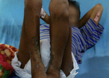 A man with mental illness in Samtse airlifted to JDWNRH for effective interventions 