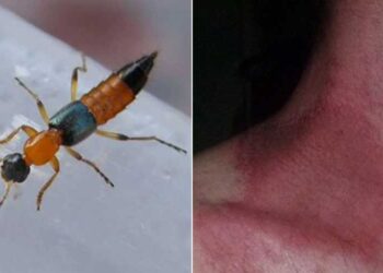 Health Ministry advises people not to panic amid reports of Nairobi fly infection