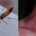 Health Ministry advises people not to panic amid reports of Nairobi fly infection