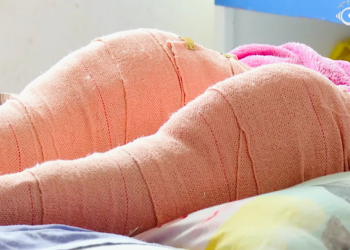 Thai Doctors perform free total knee replacement surgeries in the country