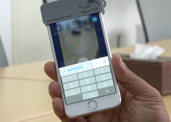 Portable Smart Eye Camera aids early diagnosis of eye diseases