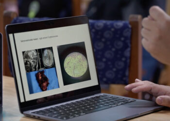 In-country neurosurgery services expand, Bhutan eyes neuro-intervention as next breakthrough