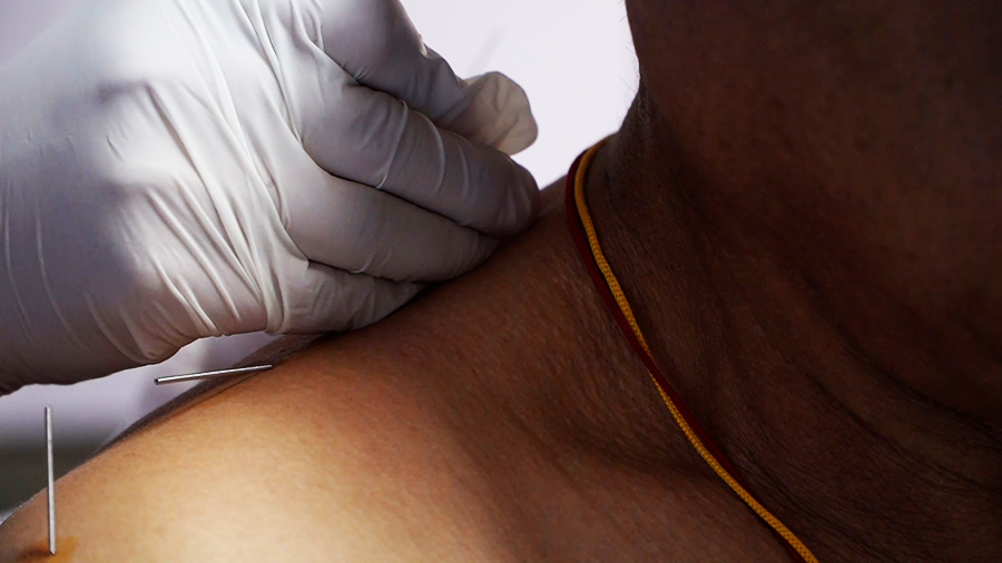 JDWNRH’s new acupuncture service strengthens integrated patient care