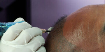 Hair tattoo trend on rise