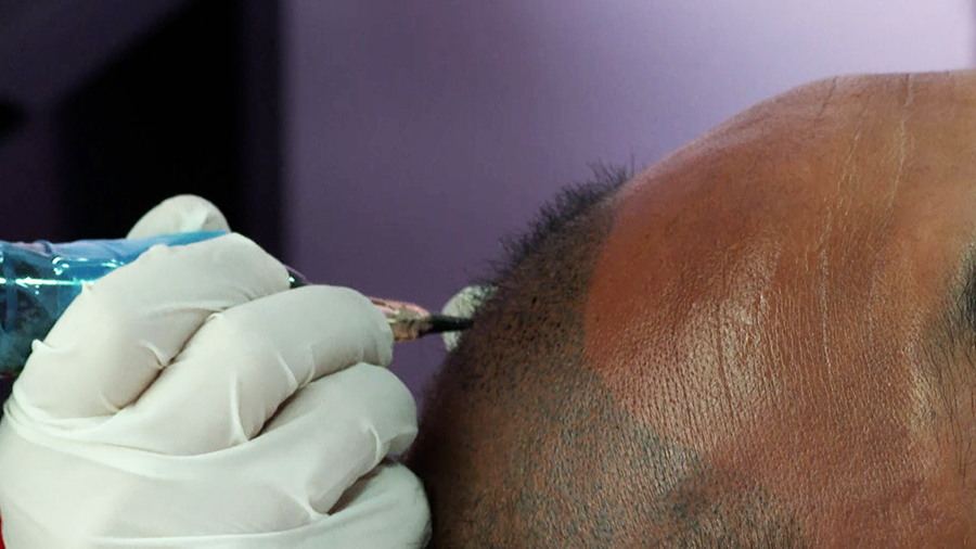 Hair tattoo trend on rise