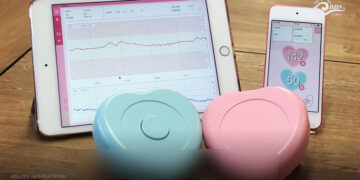 Smart pregnancy monitoring service covers 50% of pregnant women