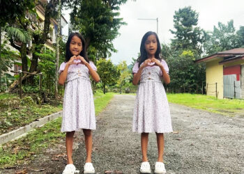 Eight years on, Bhutan’s first conjoined twins are growing into their own