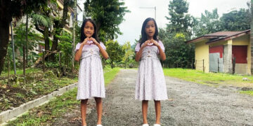 Eight years on, Bhutan’s first conjoined twins are growing into their own