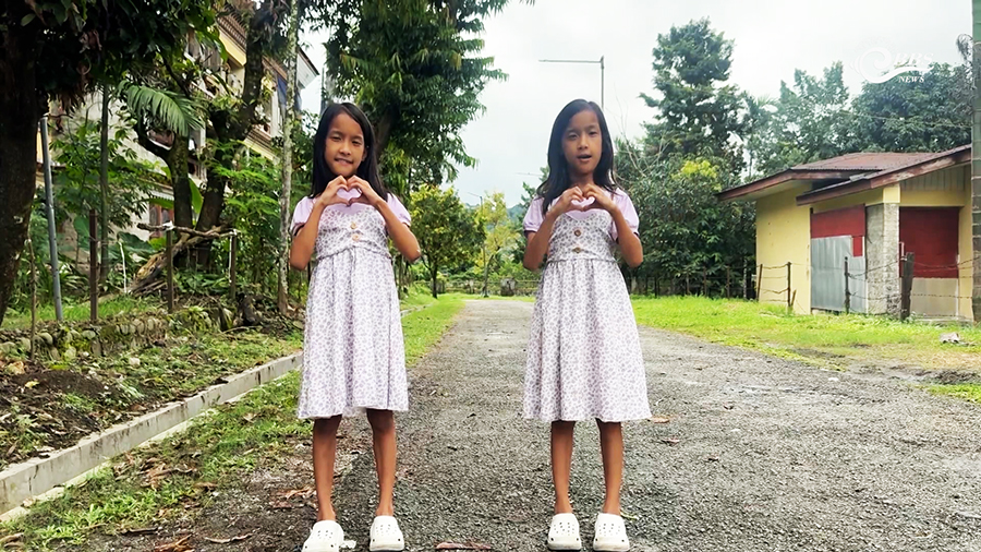 Eight years on, Bhutan’s first conjoined twins are growing into their own